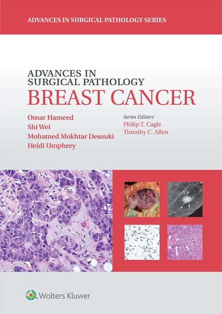 Advences in Surgical Pathology: Breast Cancer