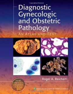 Diagnostic Gynecologic and Obstetric Pathology