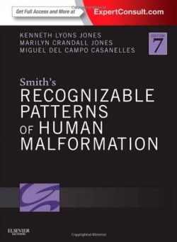Smith Recognizable Patterns of Human Malformation