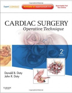 Cardiac Surgery: Operative Technique