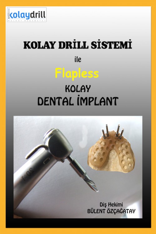 Kolay Drill Sistemi ile Flapless Kolay Dental İmplant