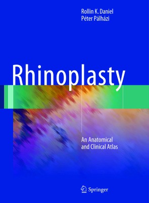 Rhinoplasty