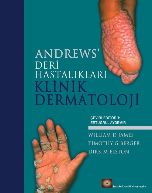 Andrew's Deri Hastalıkları Klinik Dermatoloji