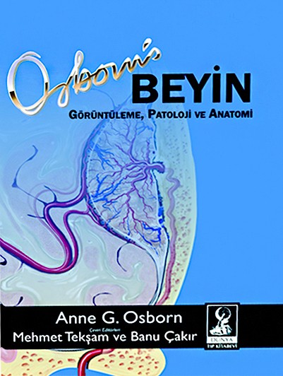 Osborn Beyin: Görüntüleme, Patoloji ve Anatomi