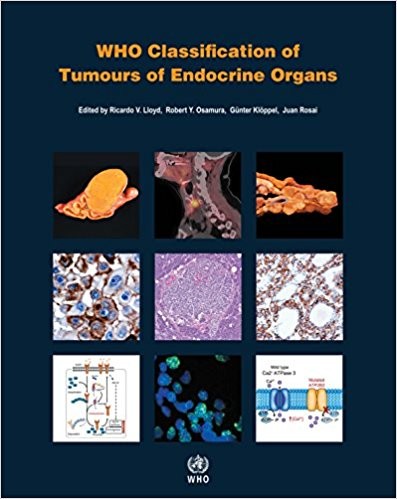 WHO Classification of Tumours of Endocrine Organs (IARC WHO Classification of Tumours)