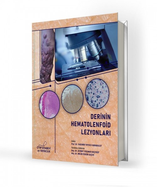 Derinin Hematolenfoid Lezyonları