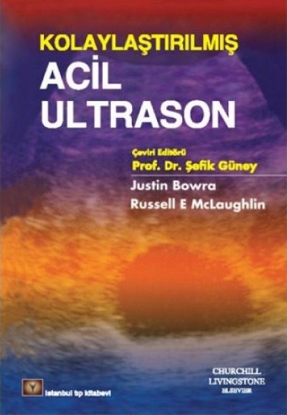 Kolaylaştırılmış Acil Ultrason