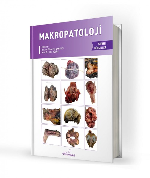 Makropatoloji