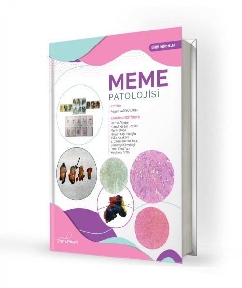 Meme Patolojisi