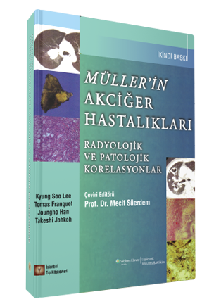 Müller'in Akciğer Hastalıkları