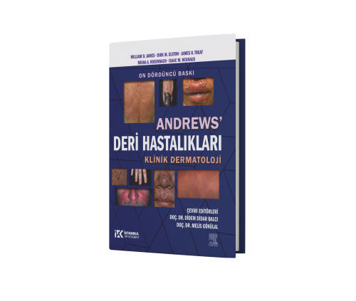 Andrew's Deri Hastalıkları Klinik Dermatoloji