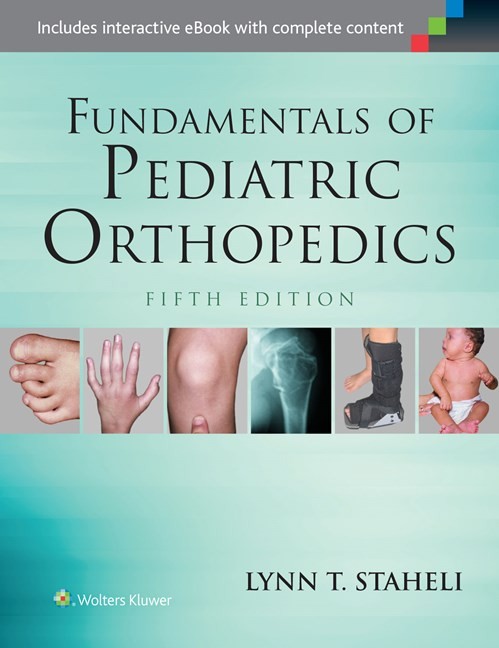 Fundamentals of Pediatric Orthopedics, 5e