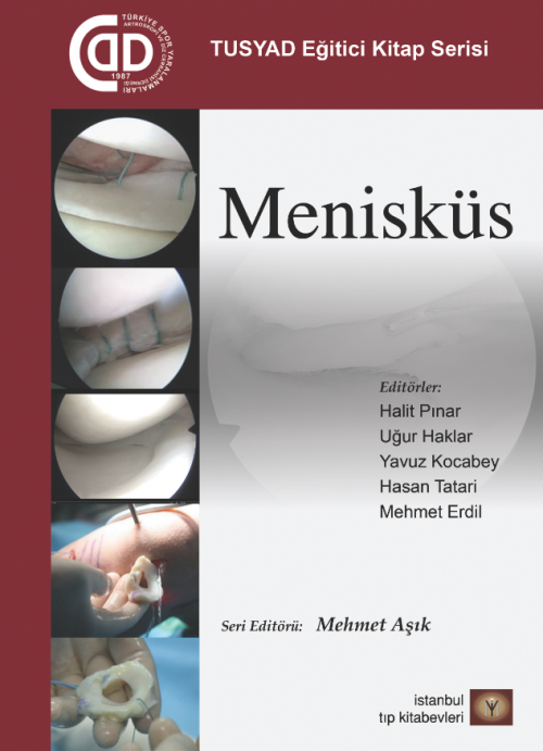 Menisküs