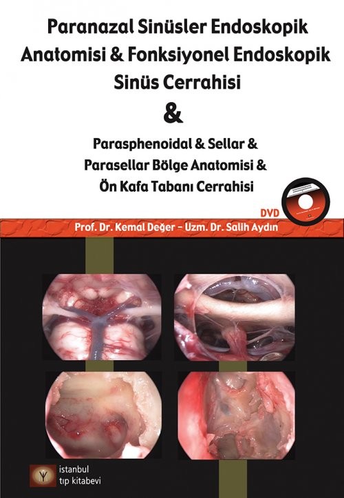 Paranazal Sinüsler Endoskopi Anatomisi & Fonksiyonel Endoskopik Sinüs Cerrahisi DVD'li