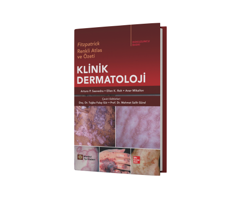 Fitzpatrick Renkli Atlas ve Özeti Klinik Dermatoloji