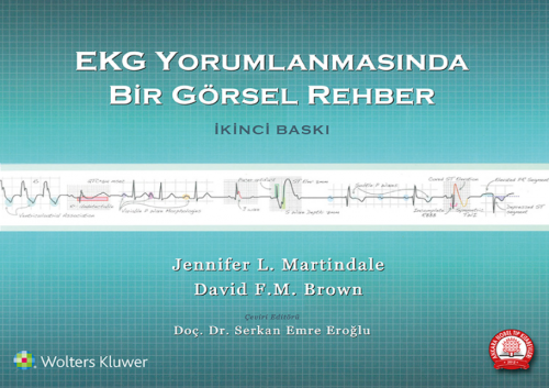 EKG'nin Acil Serviste Hızlı Yorumlanması: Görsel Rehber