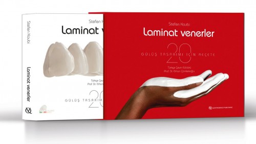 Laminat Venerler - GÜLÜŞ TASARIMI İÇİN 20 REÇETE