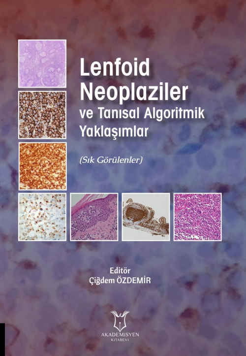 Lenfoid Neoplaziler ve Tanısal Algoritmik Yaklaşımlar