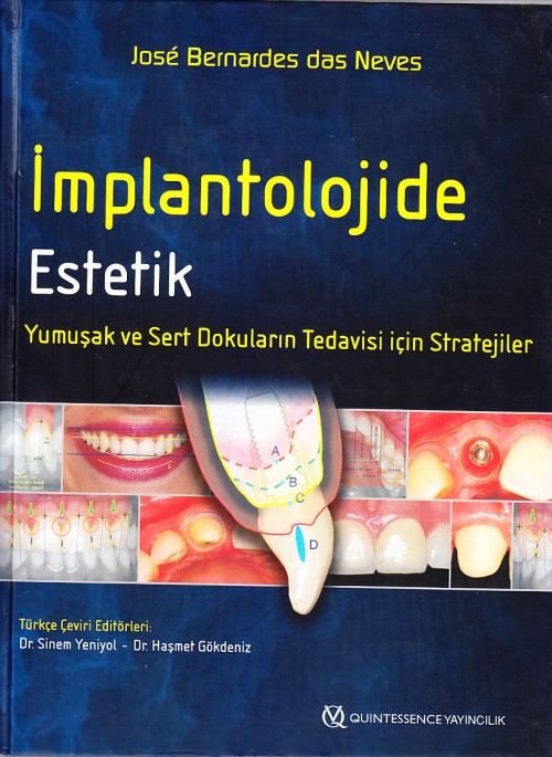 İmplantolojide Estetik Yumuşak ve Sert Dokuların Tedavisi için Stratejiler