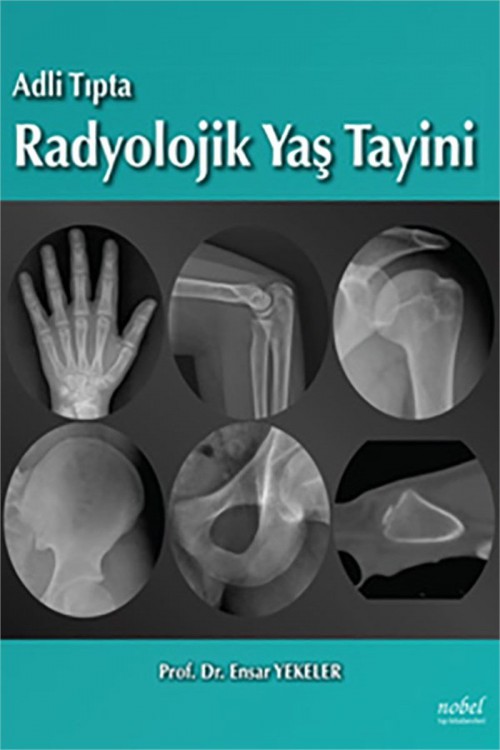 Adli Tıpta Radyolojik Yaş Tayini