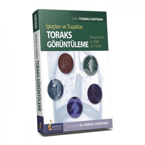 İpuçları ve Tuzaklar Toraks Görüntüleme