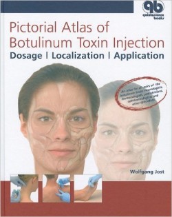 Pictorial Atlas of Botulinum Toxin Injection