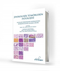Jinekolojik Tümörlerin Patolojisi