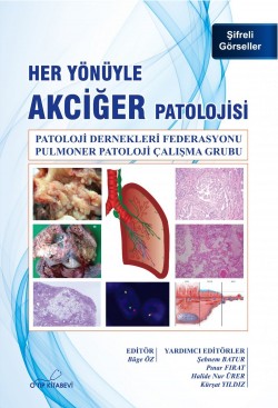 Her Yönüyle Akciğer Patolojisi