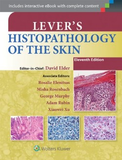 Lever's Histopathology of the Skin