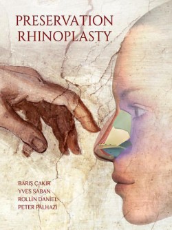 Preservation Rhinoplasty