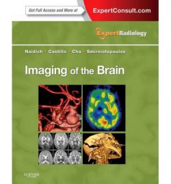 Imaging of the Brain