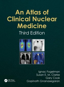 Atlas of Clinical Nuclear Medicine, 3e