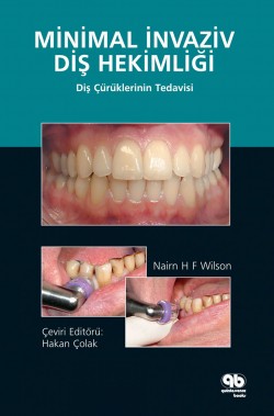 Minimal İnvaziv Diş Hekimliği