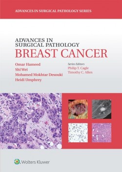 Advences in Surgical Pathology: Breast Cancer