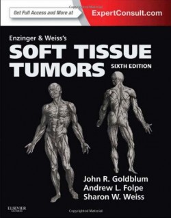 Enzinger and Weiss Soft Tissue Tumors