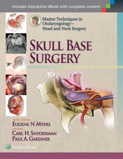 Skull Base Surgery Master Techniques in Otolaryngology