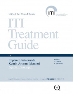 ITI Treatment Guide VOL 7 - İmplant Hastalarında Kemik Artırım İşlemleri Aşamalı Yaklaşım