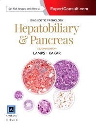 Diagnostic Pathology: Hepatobiliary and Pancreas, 2e