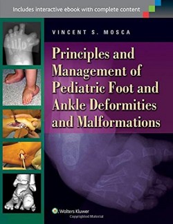 Pediatric Foot and Ankle Deformities and Malformations