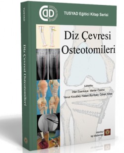 Diz Çevresi Osteotomileri