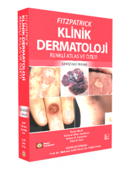 FITZPATRICK Klinik Dermatoloji Renkli Atlas ve Özeti