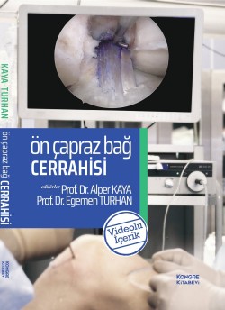 Ön Çapraz Bağ Cerrahisi