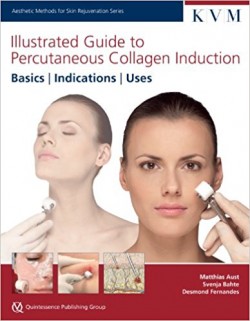 Illustrated Guide to Percutaneous Collagen Induction