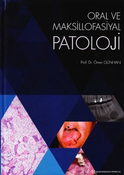 Oral ve Maksillofasiyal Patoloji