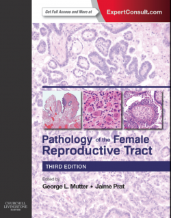 Pathology of the Female Reproductive Tract