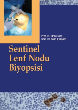 Sentinel Lenf Nodu Biyopsisi