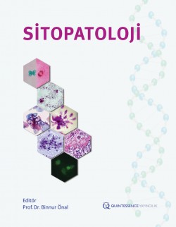 Sitopatoloji