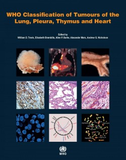 WHO Classification of Tumours of the Lung, Pleura, Thymus and Heart