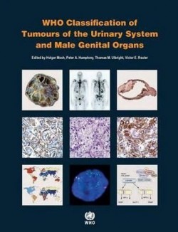 WHO Tumours of the Urinary and Male Genital Organs