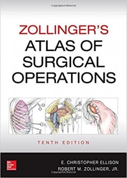 Zollinger's Atlas of Surgical Operations, 10e
